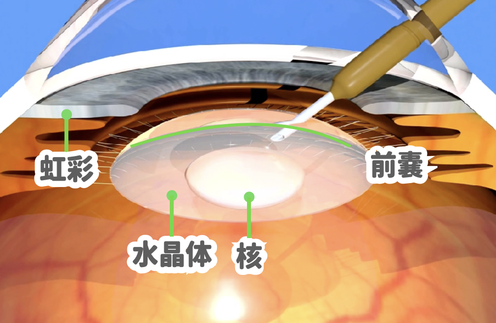 犬の白内障の手術｜手術で白内障を治療する前に知っておきたいこと